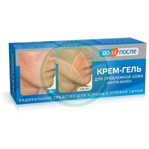 До и после крем-гель анти-акне д/пробл. кожи 50мл. /твинс тэк/ купить в Хадыженске