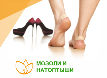 Мозоли и натоптыши