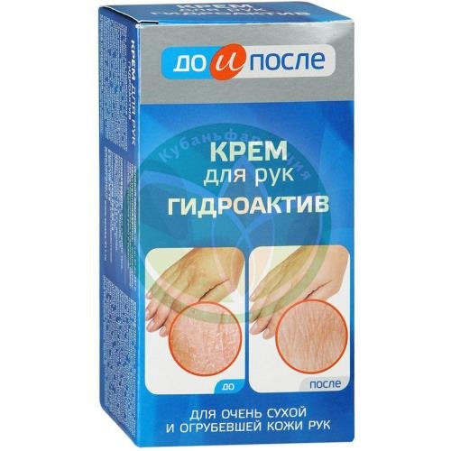 До и после крем д/рук гидроактив 100мл. /твинс тэк/ купить в Сочи